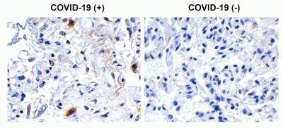Immunohistochemistry: SARS-CoV-2 nsp2 Antibody - BSA Free [NBP3-07052]