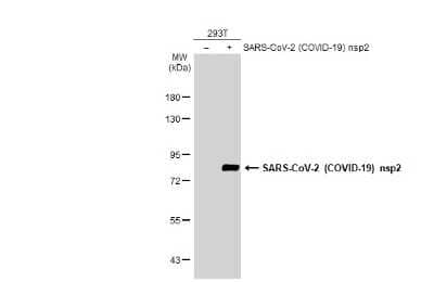 Western Blot: SARS-CoV-2 nsp2 Antibody [NBP3-13469]
