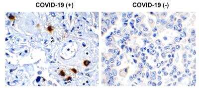 Immunohistochemistry: SARS-CoV-2 nsp7 Antibody - BSA Free [NBP3-07048]