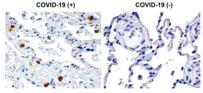 Immunohistochemistry: SARS-CoV-2 nsp8 Antibody - BSA Free [NBP3-07046]