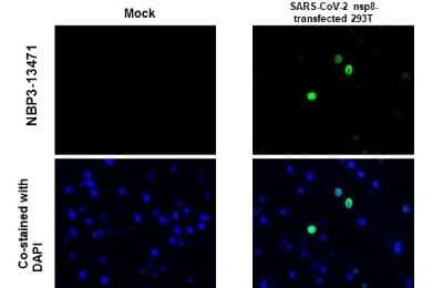 Immunohistochemistry-Paraffin: SARS-CoV-2 nsp8 Antibody [NBP3-13471]