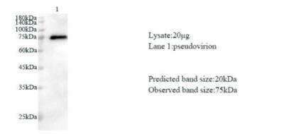 Western Blot: SARS-CoV-2 nsp8 AntibodyAzide and BSA Free [NBP3-07968]