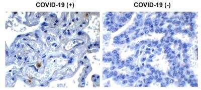 Immunohistochemistry: SARS-CoV-2 nsp9 Antibody - BSA Free [NBP3-07044]