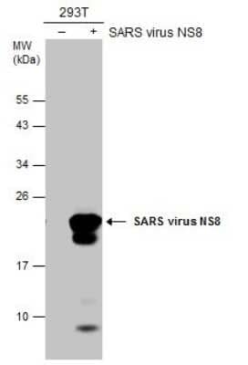 Western Blot: SARS-CoV NSP8 Antibody (5A10) [NBP3-13528]