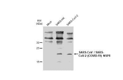 Western Blot: SARS-CoV NSP8 Antibody (5A10) [NBP3-13528]