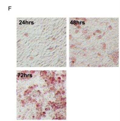 Immunohistochemistry: SARS Nucleocapsid Protein Antibody - BSA Free [NB100-56576]