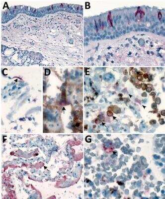 Immunohistochemistry: SARS Nucleocapsid Protein Antibody - BSA Free [NB100-56576]