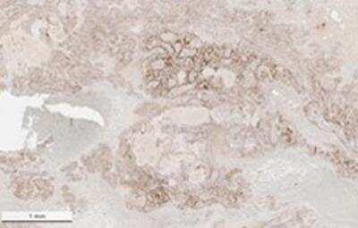 Immunohistochemistry: SARS Nucleocapsid Protein Antibody [NBP2-44205]