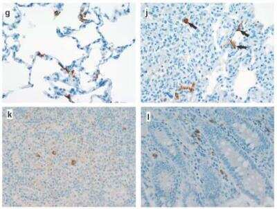 Immunohistochemistry: SARS Nucleocapsid Protein Antibody Pack [NBP3-05695]