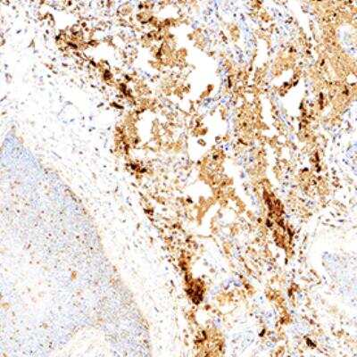 Immunohistochemistry: SARS Nucleocapsid Protein Antibody Pack [NBP3-05695]