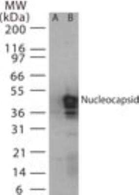 Western Blot: SARS Nucleocapsid Protein Antibody Pack [NBP3-05695]