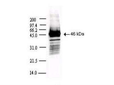 Western Blot: SARS Nucleocapsid Protein Antibody Pack [NBP3-05695]