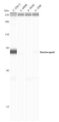 Simple Western: SARS Nucleocapsid Protein Antibody [NB100-56683]