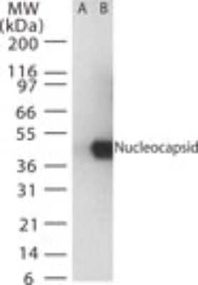 Western Blot: SARS Nucleocapsid Protein AntibodyBSA Free [NB100-56576]