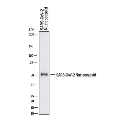 Western Blot: SARS Nucleocapsid Protein AntibodyBSA Free [NB100-56576]