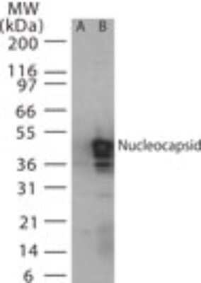 Western Blot: SARS Nucleocapsid Protein Antibody [NB100-56683]