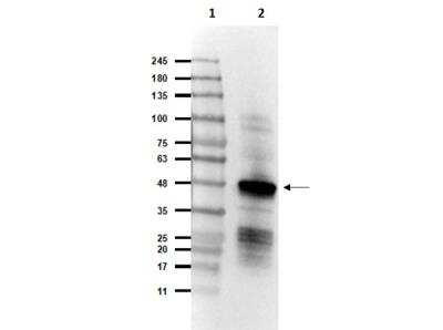Western Blot: SARS Nucleocapsid Protein Antibody [NBP2-44205]