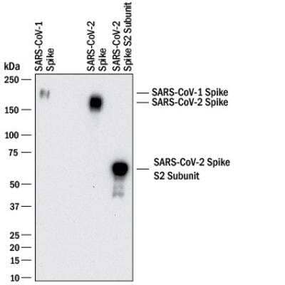 Western Blot Detection of SARS-CoV-1 and SARS CoV-2 Spike Protein Using SARS Spike Protein Antibody