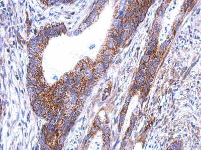 Immunohistochemistry-Paraffin: SARS2 Antibody [NBP2-20262]