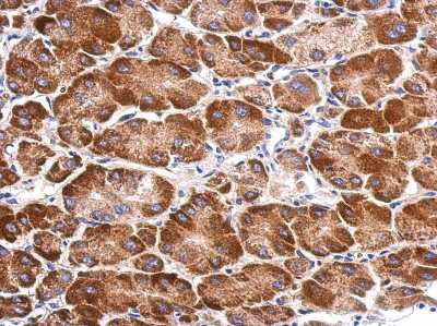 Immunohistochemistry-Paraffin: SARS2 Antibody [NBP2-20263]