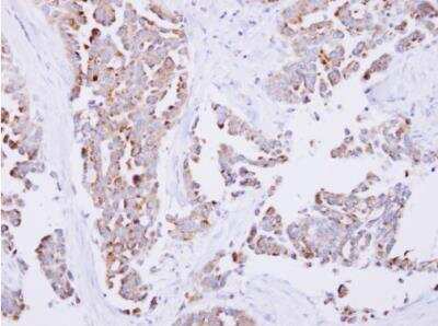 Immunohistochemistry-Paraffin: SARS2 Antibody [NBP2-20263]