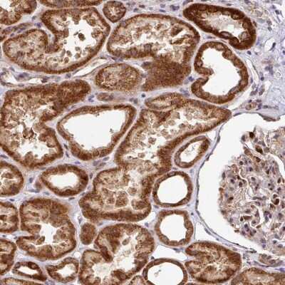 Immunohistochemistry-Paraffin: SARS2 Antibody [NBP2-33666]