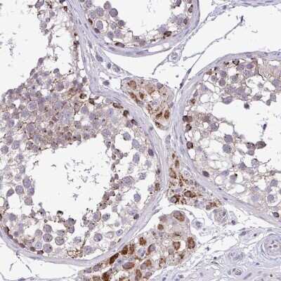Immunohistochemistry-Paraffin: SARS2 Antibody [NBP2-33807]