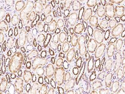 Immunohistochemistry-Paraffin: SARS2 Antibody [NBP2-97631]