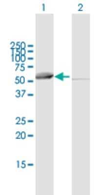 Western Blot: SARS2 Antibody [H00054938-B01P]
