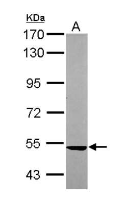 Western Blot: SARS2 Antibody [NBP2-20262]