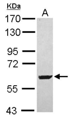 Western Blot: SARS2 Antibody [NBP2-20263]