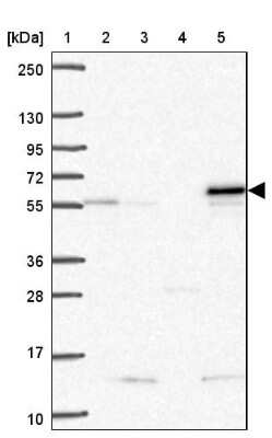 Western Blot: SARS2 Antibody [NBP2-33807]