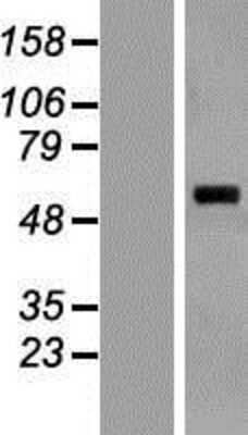 Western Blot: SARS2 Overexpression Lysate [NBL1-15695]