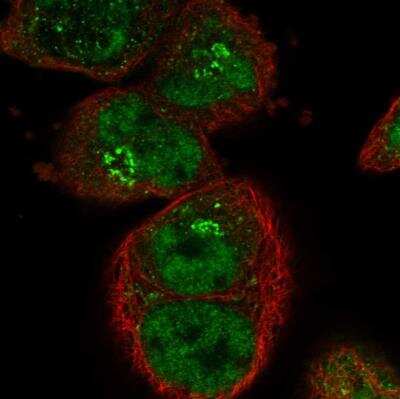 Immunocytochemistry/ Immunofluorescence: SART1 Antibody [NBP1-89022]