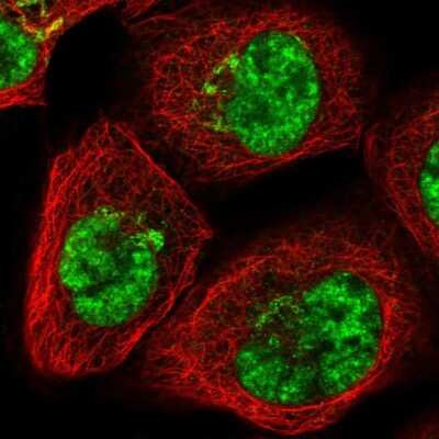 Immunocytochemistry/ Immunofluorescence: SART1 Antibody [NBP1-89023]