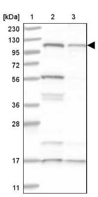 Western Blot: SART1 Antibody [NBP1-89022]