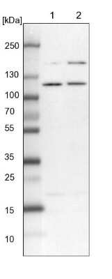 Western Blot: SART1 Antibody [NBP1-89022]