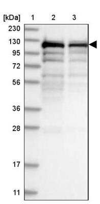 Western Blot: SART1 Antibody [NBP1-89023]