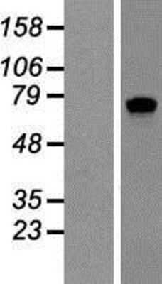 Western Blot: SART1 Overexpression Lysate [NBP2-07786]