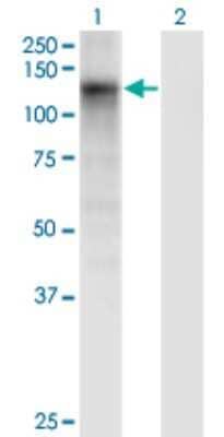 Western Blot: SART2 Antibody (6D4) [H00029940-M03]