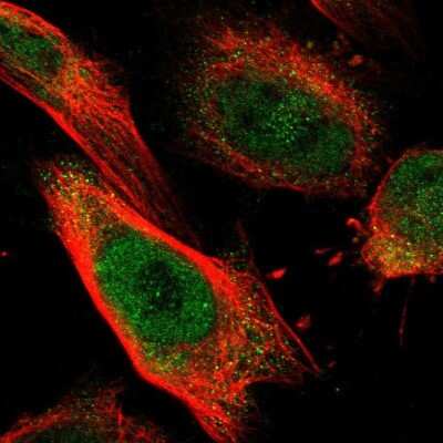 Immunocytochemistry/ Immunofluorescence: SART2 Antibody [NBP1-87962]