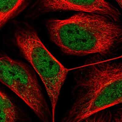 Immunocytochemistry/ Immunofluorescence: SART2 Antibody [NBP2-58454]