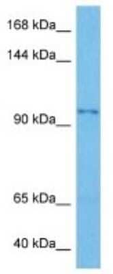 Western Blot: SART2 Antibody [NBP3-11007]