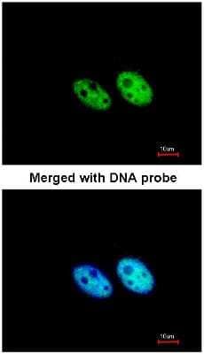 Immunocytochemistry/ Immunofluorescence: SART3 Antibody [NBP1-31487]