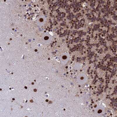 Immunohistochemistry-Paraffin: SART3 Antibody [NBP2-13281]