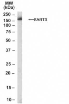 Western Blot: SART3 Antibody [NB100-1893]