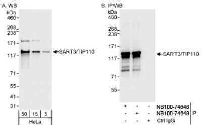 Western Blot: SART3 Antibody [NB100-74648]