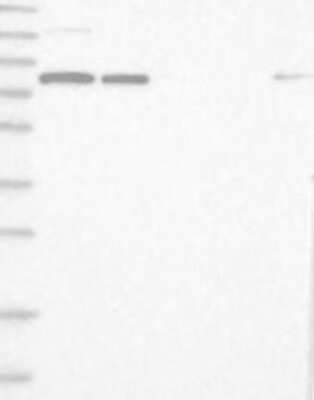 Western Blot: SART3 Antibody [NBP3-17928]