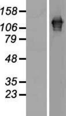 Western Blot: SART3 Overexpression Lysate [NBL1-15696]