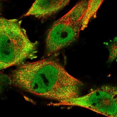 Immunocytochemistry/ Immunofluorescence: SASH1 Antibody [NBP1-85183]